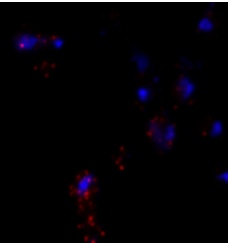 mRNA expression